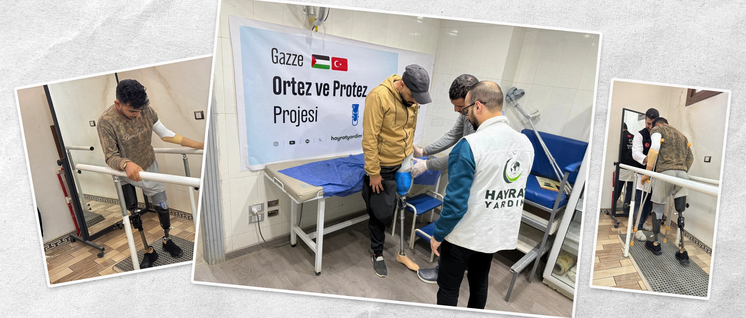 Bir Protez, Bir Hayatı Değiştirir